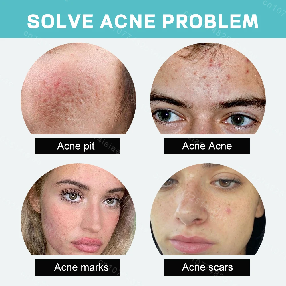 Face Cream Shrink Pores Repair