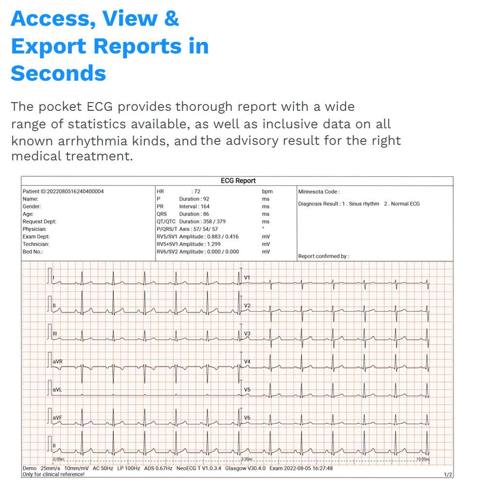 WIFI Portable ECG Machine Handheld Pocket ECG Machine Chargeable 6/12-Lead Glasgow Data Analysis Transfer 250g