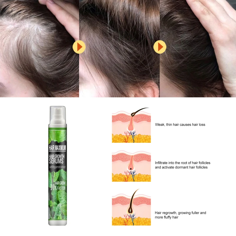 Description Picture 6 of item1/2PCS Hair Growth Spray Anti Hair Loss Spray Improve Root Strengthen Fast Tousle Growth Serum Thick Dense Care for Women Man