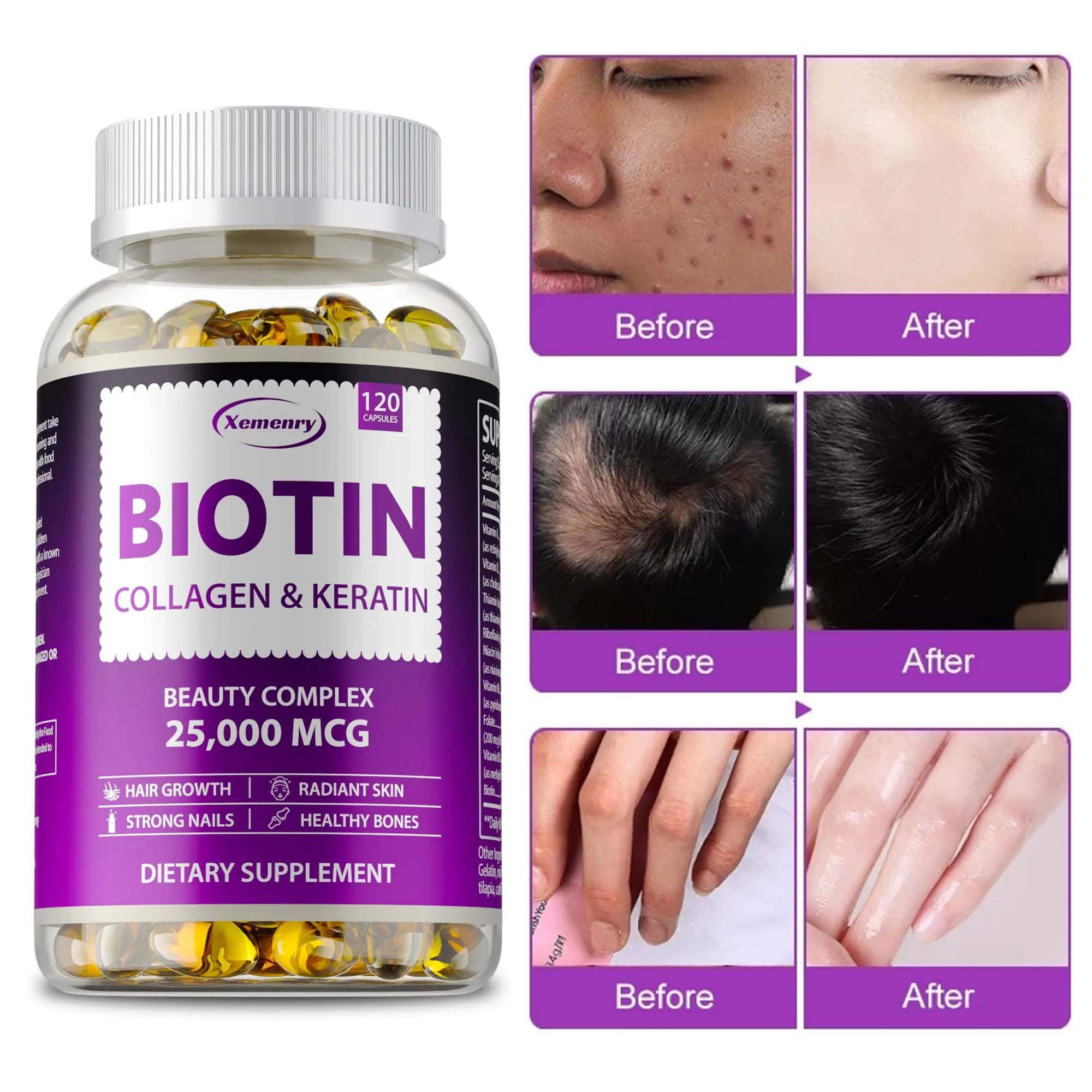 Biotin Collagen and Keratin Supplement - Support Healthy Hair, Strong Nails and Radiant Skin - Hair Growth for Men and Women