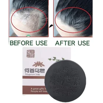 폴리고눔 멀티플로럼 드라이 헤어 남녀공용 샴푸 비누, 손실 방지, 화이트 턴 블랙, 항소양제, 촉촉한 리페어, 품질 건강 관리