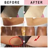 Nicotinamide Brightening Cream For Dark Skin Effective Lighten Thigh Inner Bleach Remove Melanin Private Parts Brighten Cream 4