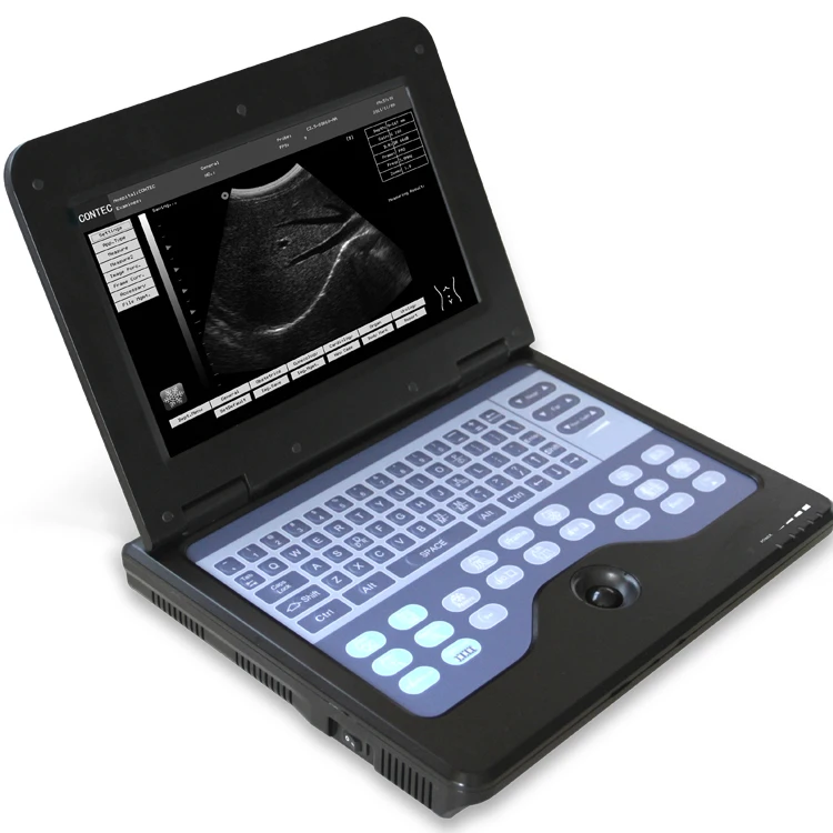 

Производитель CONTEC CMS600P2, портативная ультразвуковая машина