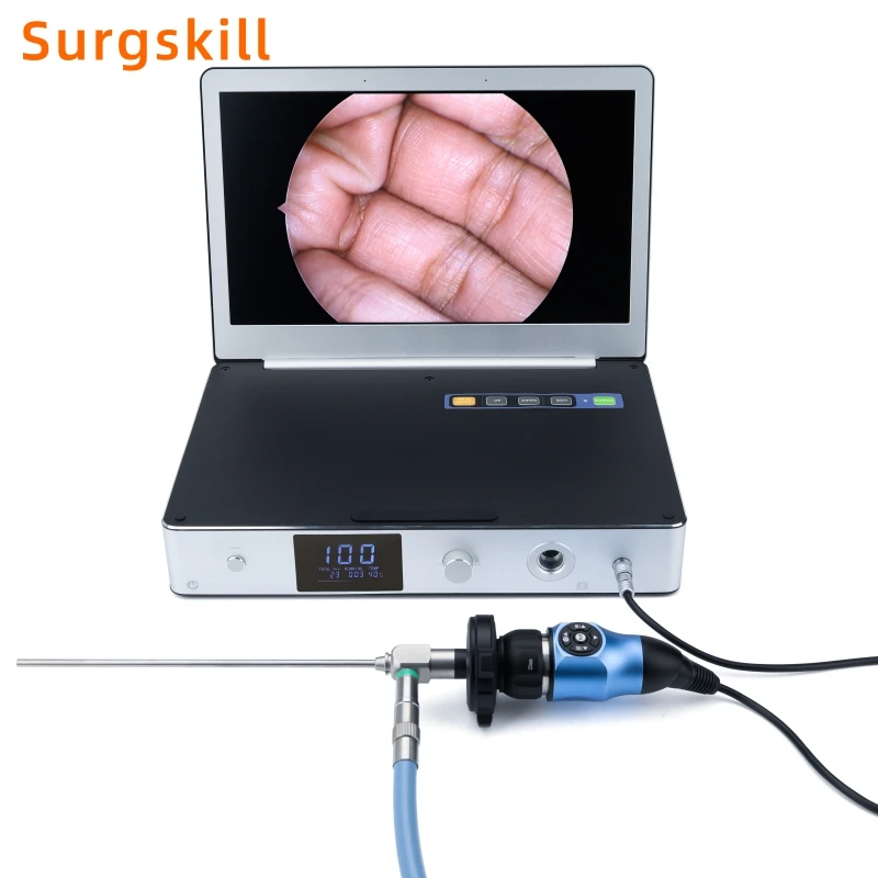 All In One Medical Endoscopy Camera System Full Hd Ent Portable