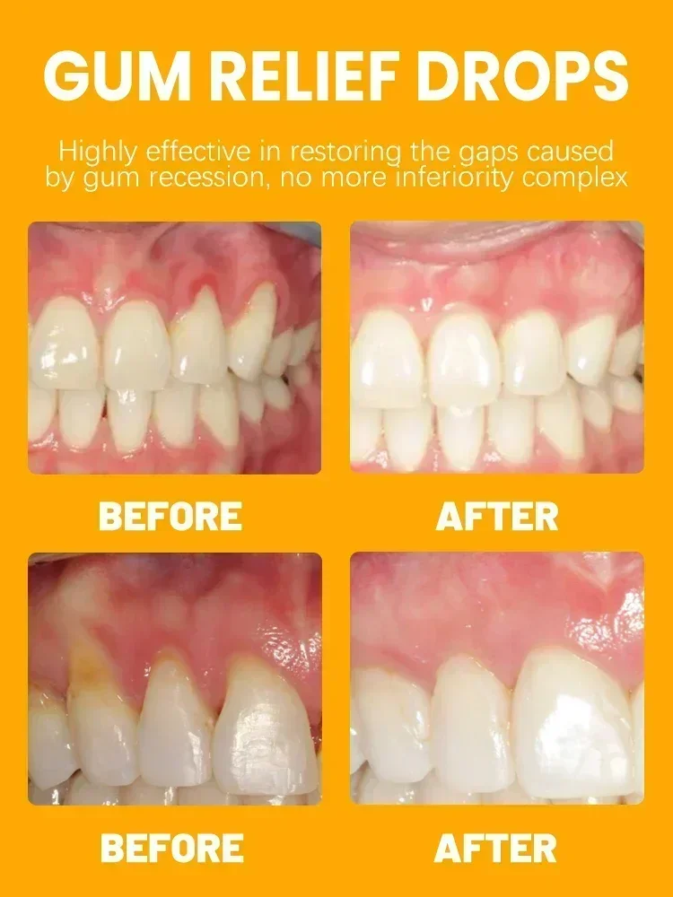 Gum Repair Drops Restore gums