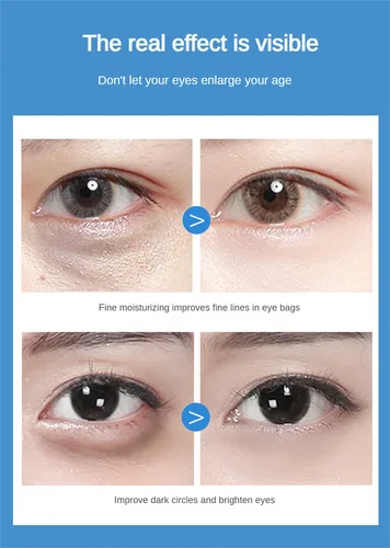 해파리 콜라겐 아이 패치 탄력 보습 아이 마스크, 부드러운 보습 아이 패치, 건조한 눈 스킨 케어 제품 개선, 60 개 4