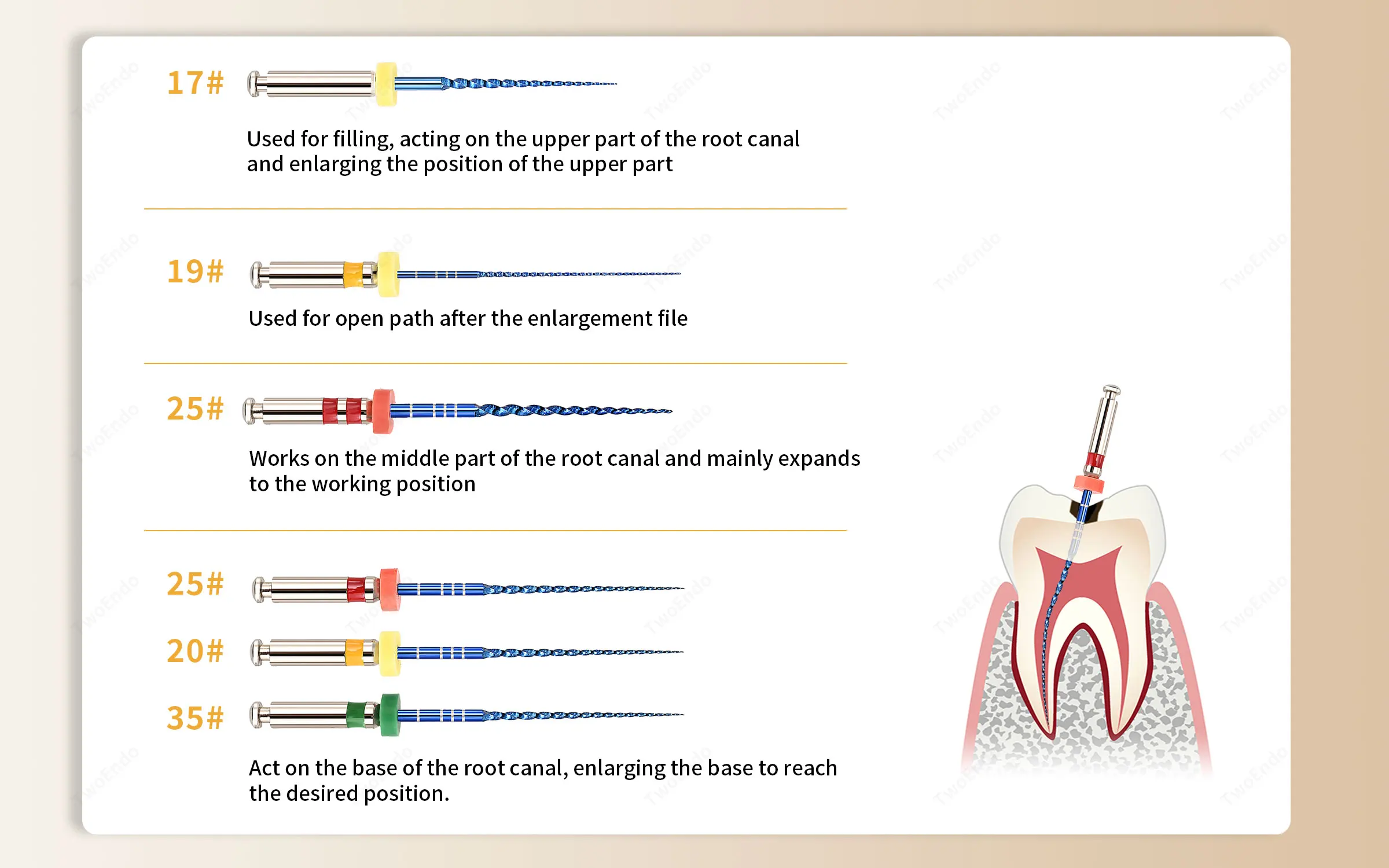 Dental Wurzelkanalfeile Endo Rotationsfeilen Endodontische Feilen 25mm Nickel Titan Instrument Zahnmedizin – Detail 3