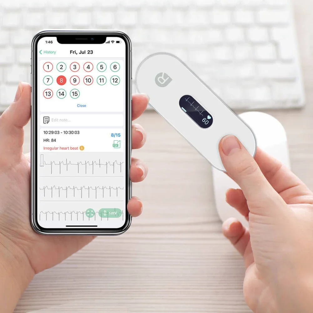 Bluetooth ECG Monitor With OLED EKG AI AnalysiArrhythmias Holter Heart Health Monitor Screen Show Real-time EKG