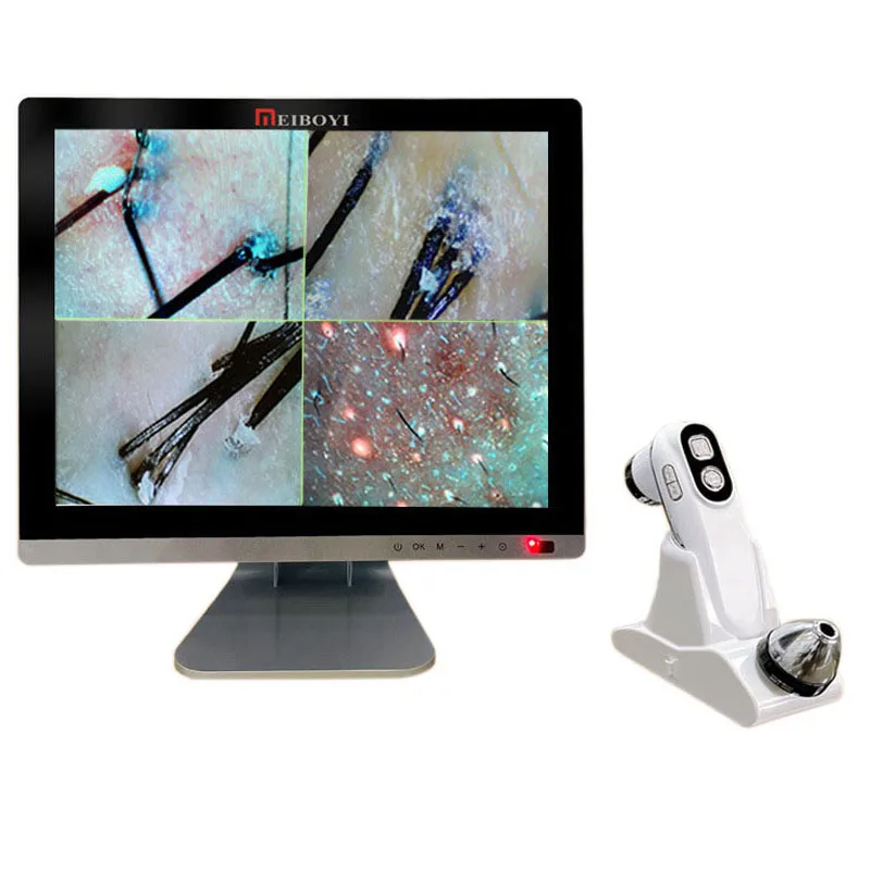 15 Inch 16G Professional Scalp Hair Follicle Oil Moisture Magnifying Detector Analyzer Skin UV Pigment Tester Hair Treatment