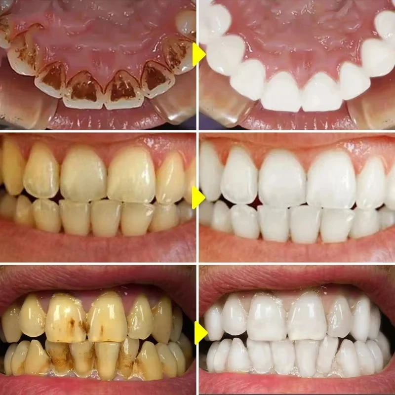 Fresh Breath Dentistry Care Teeth Whitening Toothpaste 5D Tooth Whitener Strips Oral Hygiene Cleaning Dental Bleaching Tools