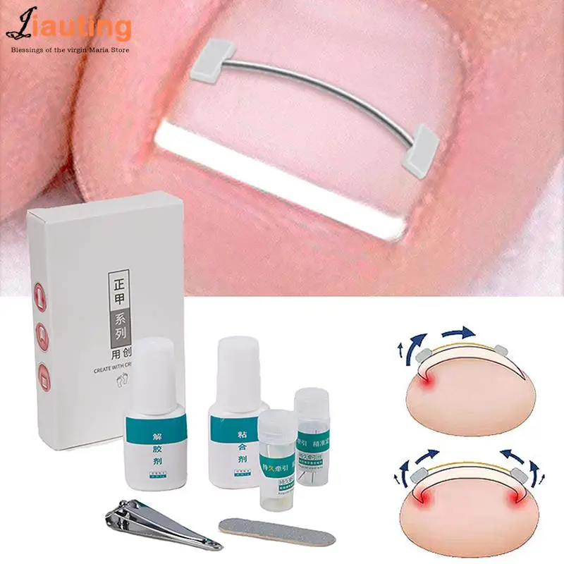 

1Set Ingrown Toe Nail Treatment Ingrown Toenail Correction Tool Elastic Patch Sticker Straightening Clip Brace Pedicure Tools