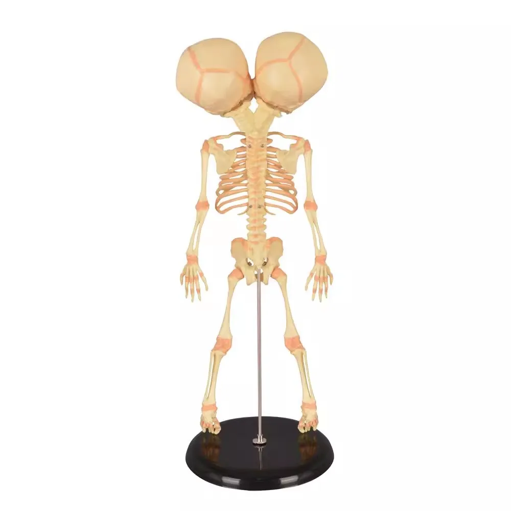 Human Double Head Baby Skull Model Skeleton Anatomy Medical Science Display Study Teaching Model