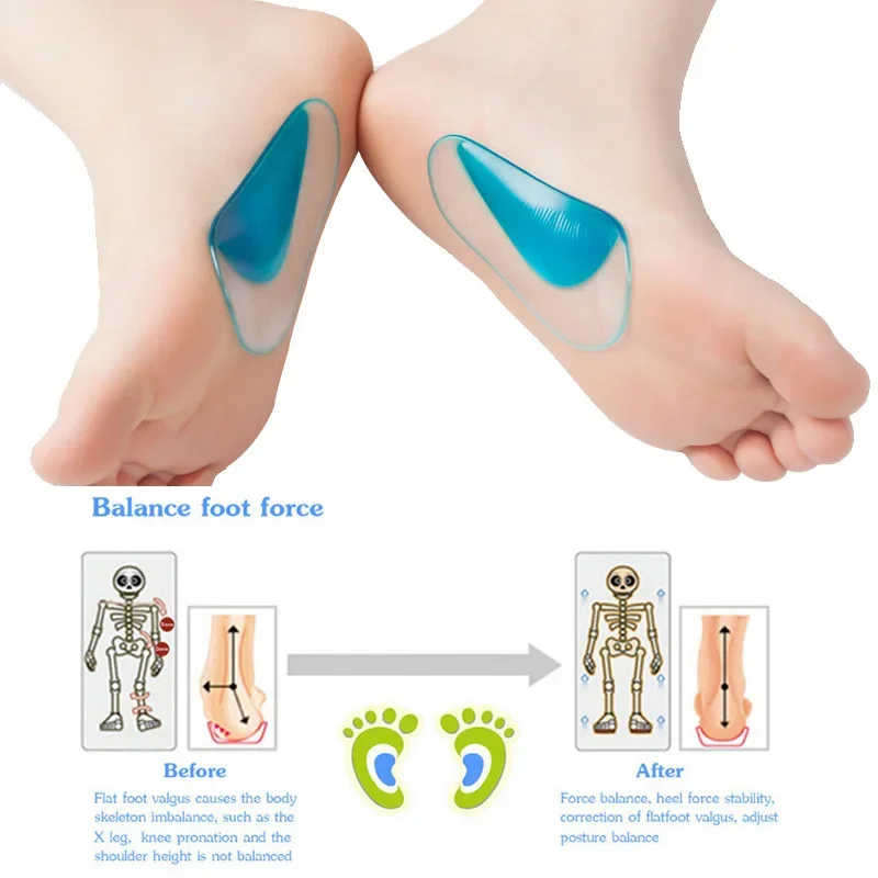 Kids Orthopedic Insoles for Children Shoes Inserts Baby Plantar Fasciitis Flat Feet Arch Support Orthotic Silicone Gel Insoles shoe insoles