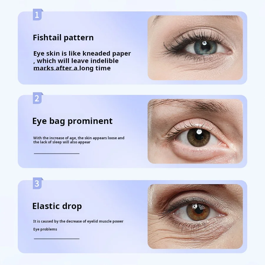 Eye Massager Eye Beauty Pen Home Lifting Face Introduction Instrument Skin Rejuvenation And Eye Beauty Instrument