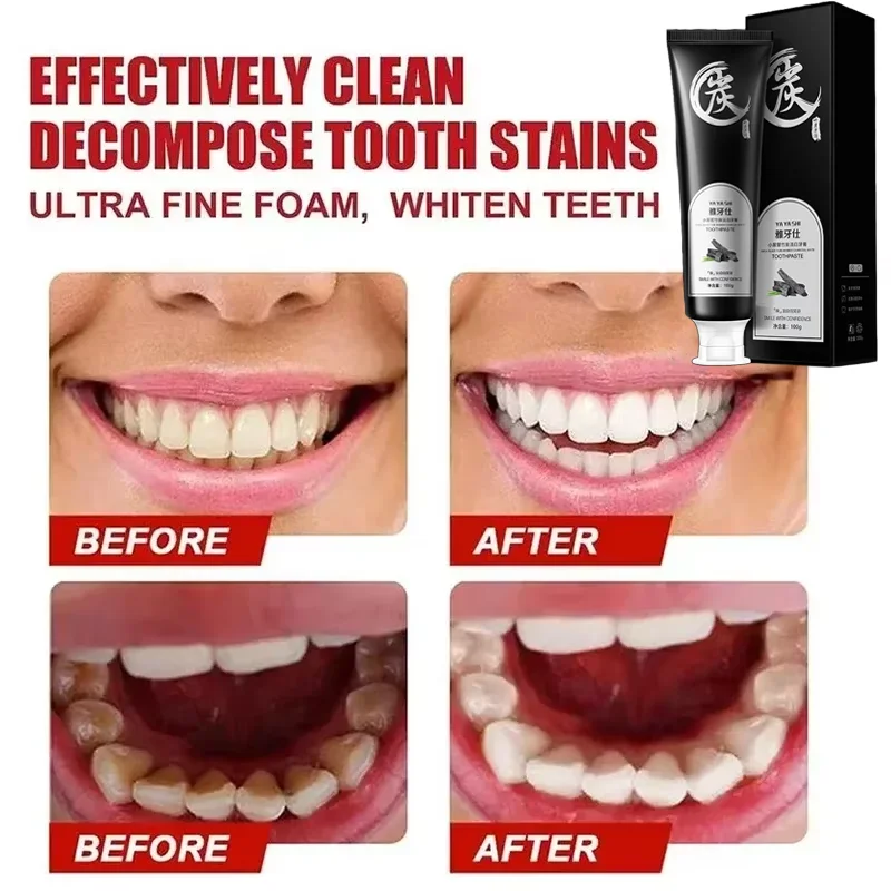 Tooth Powder Remove Plaque Stains Whiten Tooth 100g
