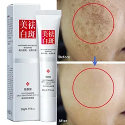 Improve Freckle Whiten Cream Effective Dullness Remove Dark Spot Melasma Fade Melanin Anti-pigmentation Brighten Face Skin Care