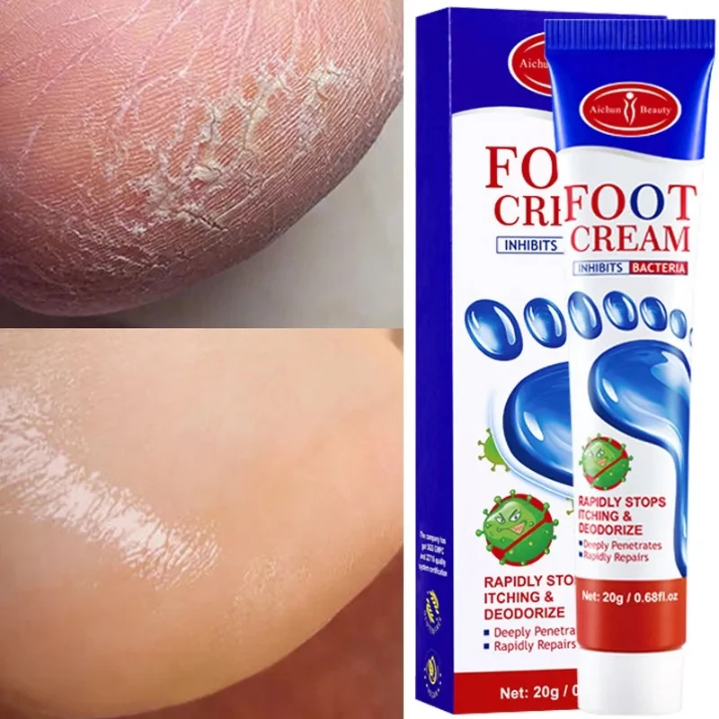 

Anti-Drying Crack Foot Hand Cream Heel Cracked Repair Hand Feet Mask Moisturizing Whitening Dead Skin Removal Skin Care Ointment