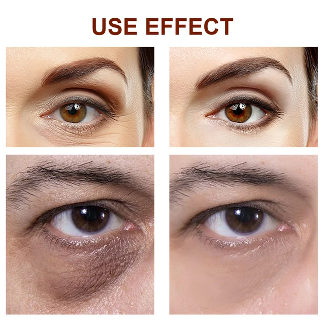 Peptide Anti-Wrinkle Eye Cream Collagen Anti Dark Circle Anti-aging Gel  3
