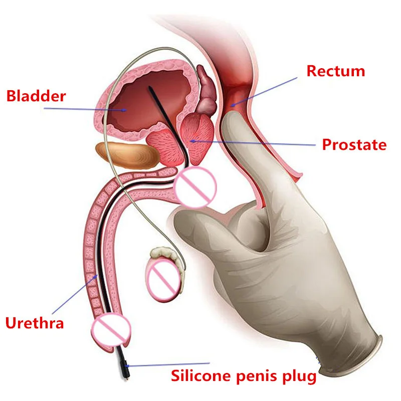 Urethral dilator silicone urethral dilator Urethral Catheter Sounding Plug Dilator Electro Stimulate Penis Plug Horse Eye Stick Electric Shock Accessories Adult Sex Toys