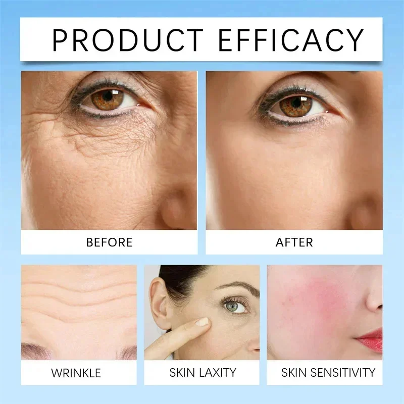 Repair Facial Redness Serum Instant Spider Vein Remove Sensitive Skin Sooth Anti Redness Rosacea Treat Lotion Korean Cosmetics 4