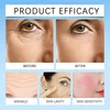 Repair Facial Redness Serum Instant Spider Vein Remove Sensitive Skin Sooth Anti Redness Rosacea Treat Lotion Korean Cosmetics 4