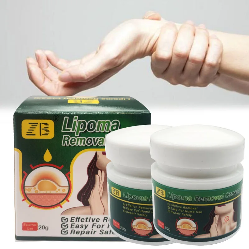 Skin Care Ointment 20g Herbal Lipoma Removal Cream Lipolysis Skin Swelling Cellulite Treatment
