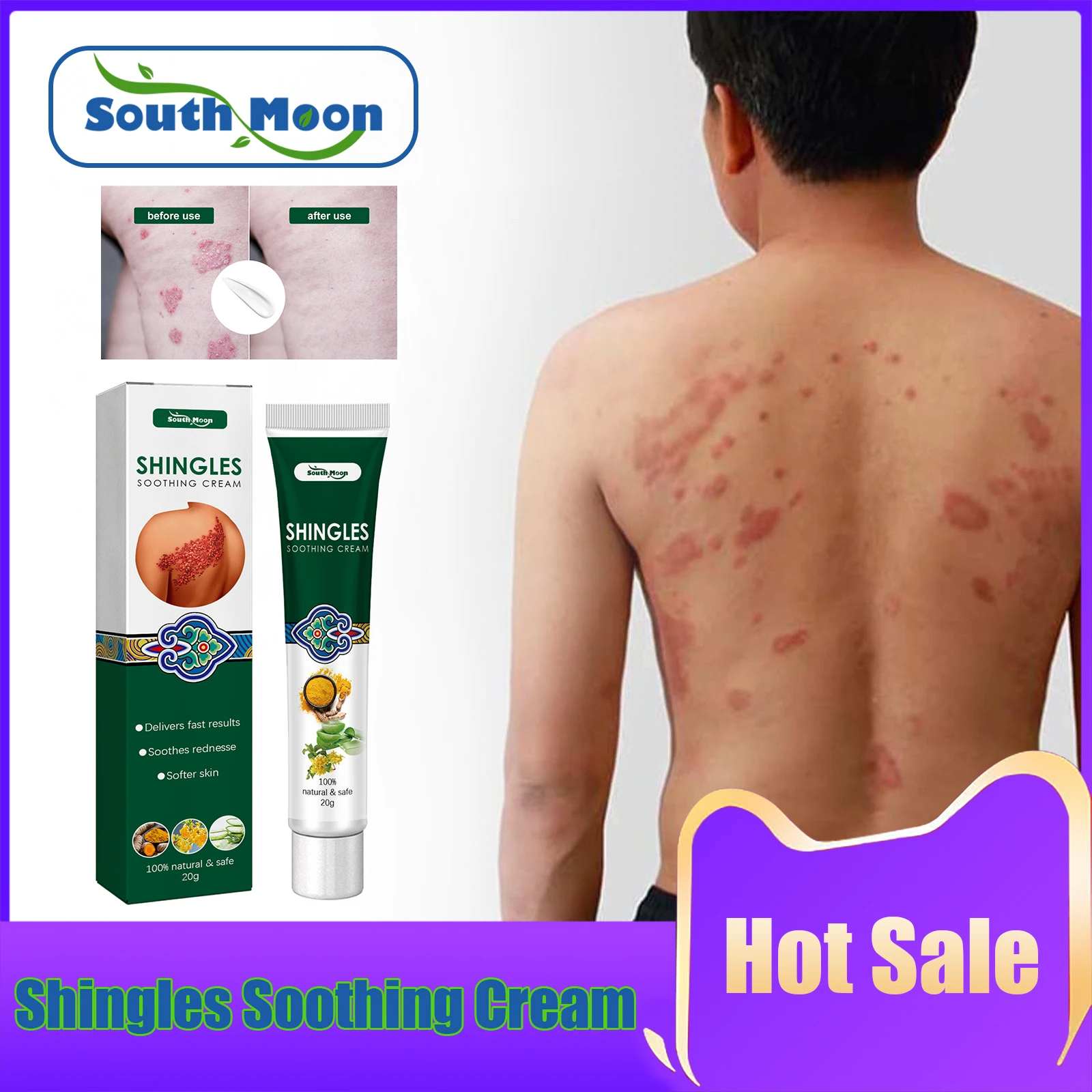 

Psoriasis Antibacterial Cream Relieve Moss Itching Relief Redness Eczema Herpes Zoster Treatment Skin Antipruritic Ointment 20g