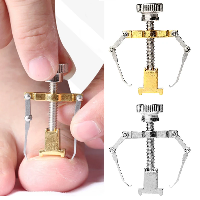 

1 Pc Pedicure Tools Professional Ingrown Nail Corrector Easily Trim Ingrown Toenails For Nail Correction Toenail Corrector