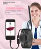 Female gynecological colposcopy, visual camera, vaginal examination, private self pickup, cervical internal examination instrume 1