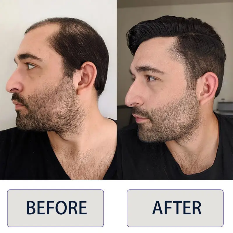 Toupee For Men Mono And Npu Base Male Hair Prosthesis Natural Human Hair Exhuast Systems Durable Men\'s Wigs Hairpieces Capillary