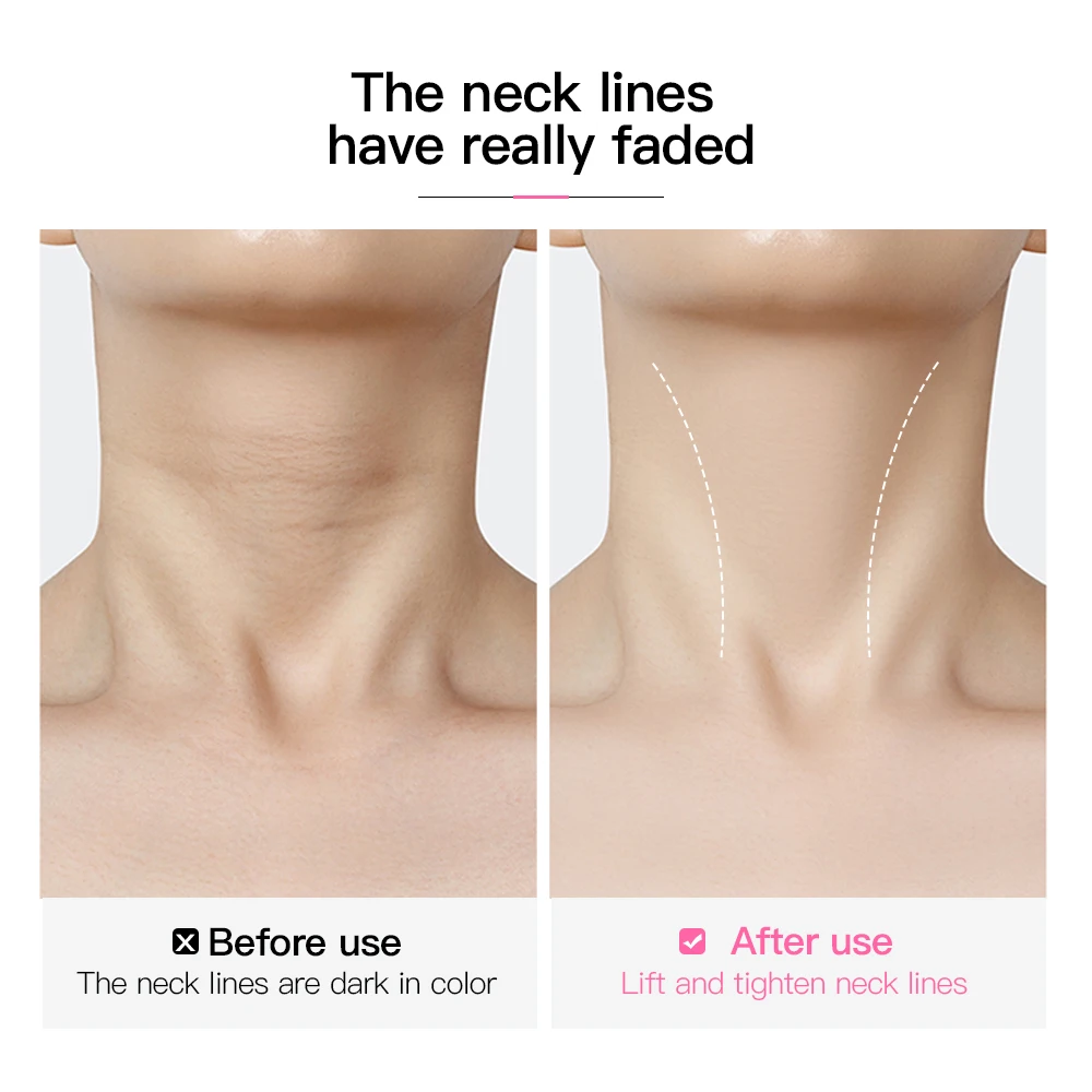 10pcs 투명 목 리프팅 패치 방수 탄력 보이지 않는 페이딩 목 주름 접착 스티커 페이스 리프트 테이프
