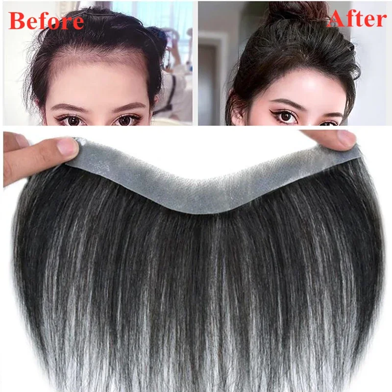 Human Hair Bangs Replacement System For Baldness