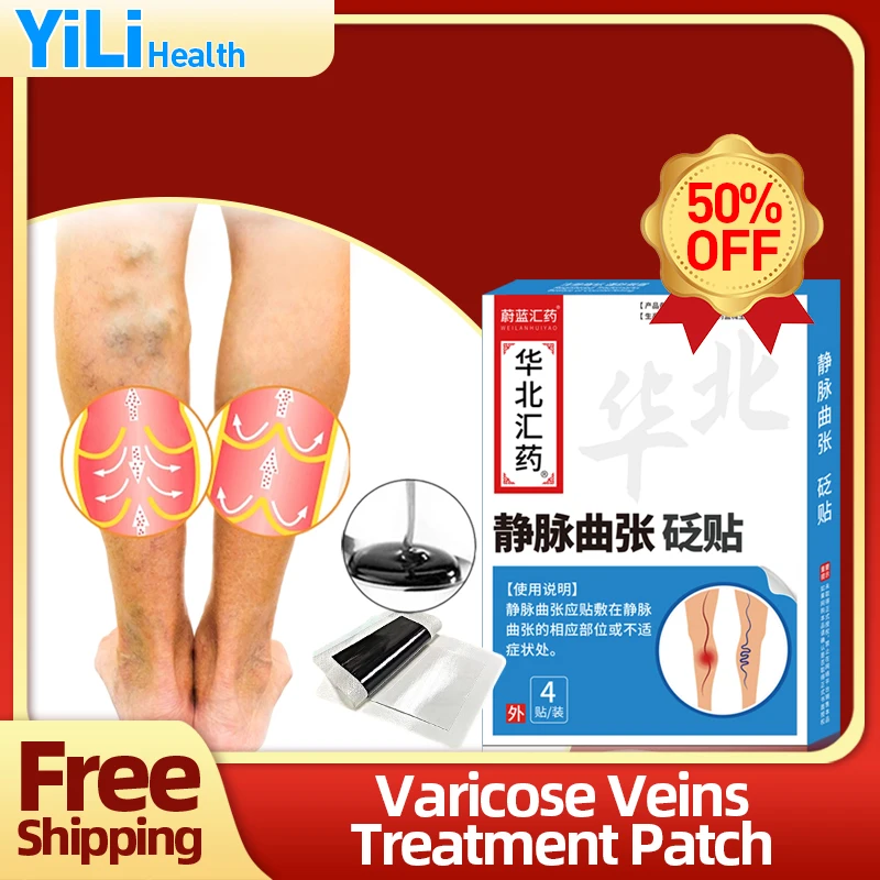 

Varicose Veins Treatment Patch Spider Legs Vasculitis Phlebitis Removal Varicocele Vein Vulvar Varicosity Repair Medicine