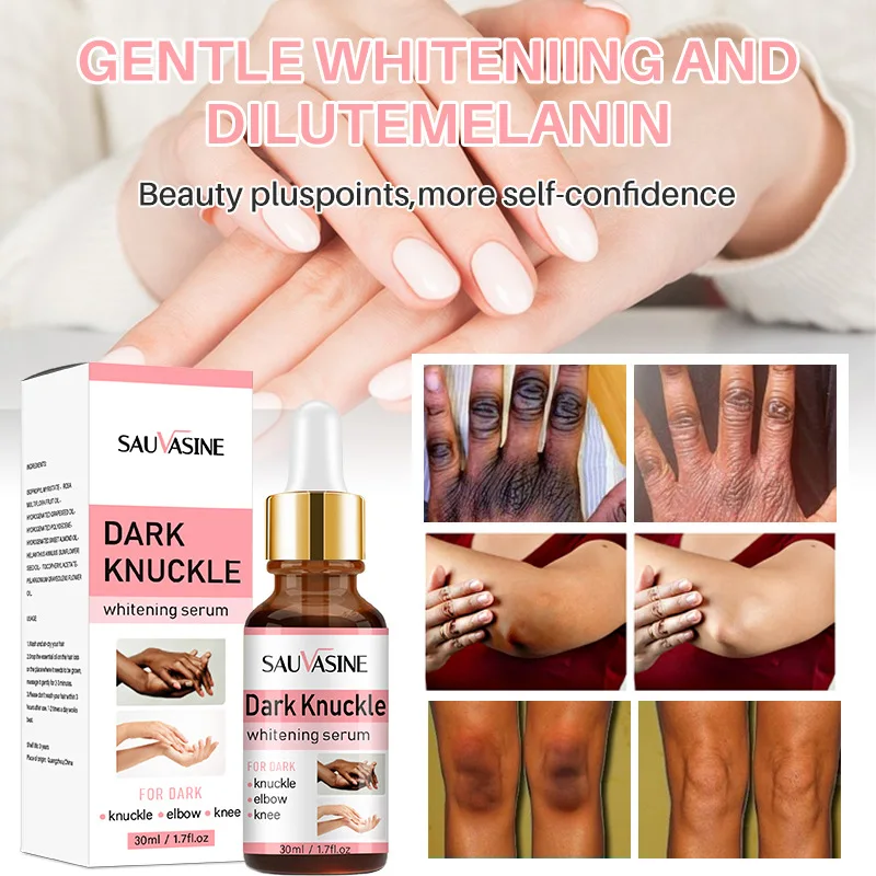 

Niacinamide Body Whitening Serum Lightening Melanin Removing Knuckles Knee Hips Dullness Private Parts Brighten Beauty Skin Care