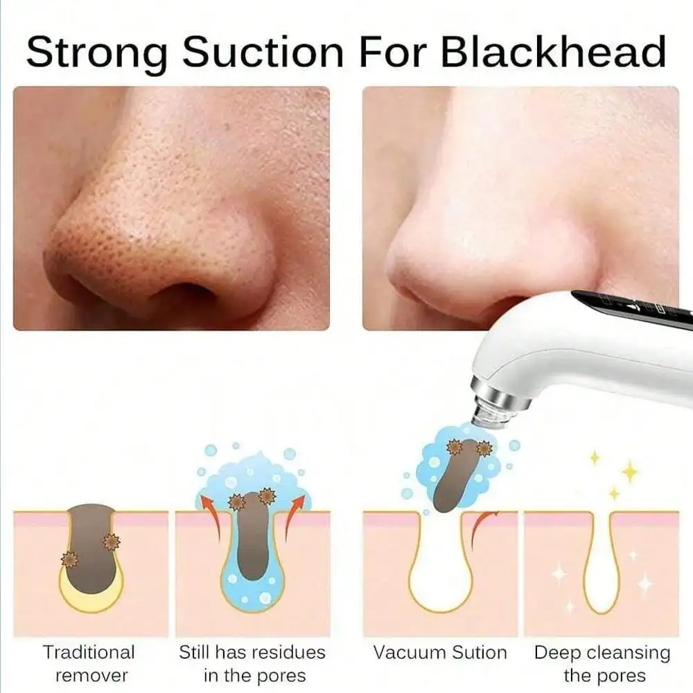 Blackhead Remover Pore Vacuum Facial Cleaner Electric Acne Remover Blackhead USB Charging