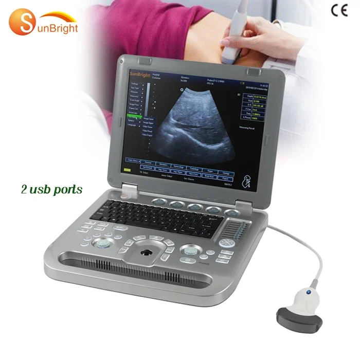 Ce Portatile Digital Doppler Ultrasound System Dispositivi Ecografo Sun-800D