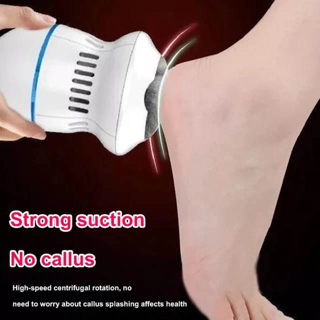 Electric USB Vacuum Callus Grinder Foot File Pedicure Dead Skin Remover  Rotating