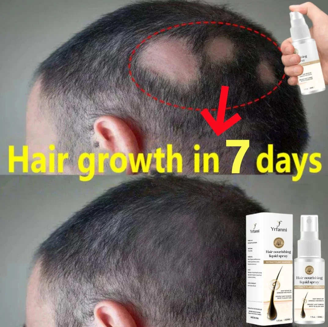 Ginger Hair Growth Serum Spray Promote Hair Root Fast Grow Prevent Baldness Hair Loss Treatment Hair Regrowth Thicker Hair Care hair growth essential oils serum products anti effective baldness