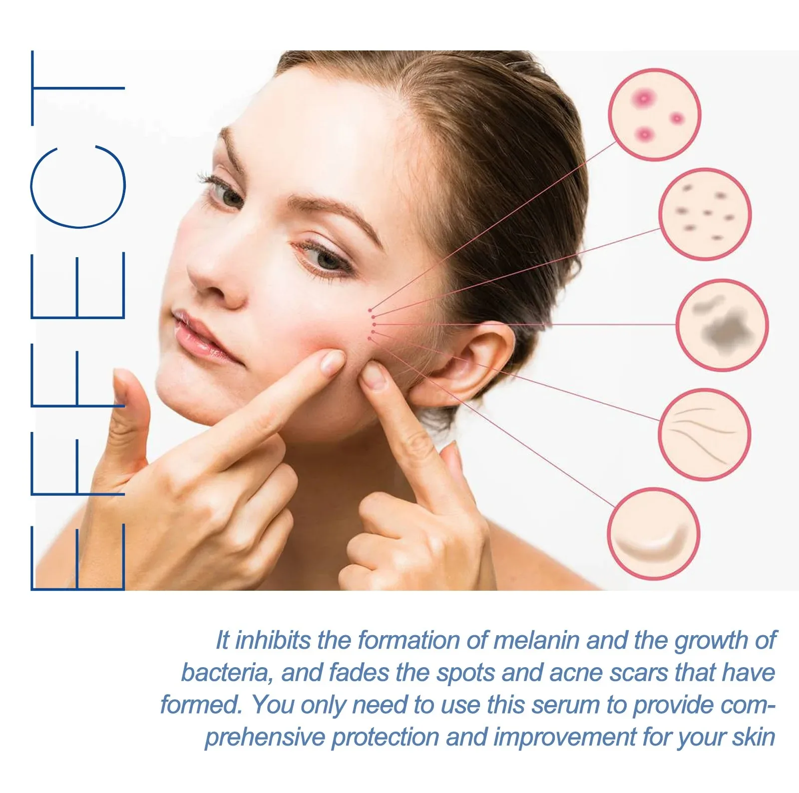 Dark Spot Corrector Serum Repairing Pimples Acne Removal Whitening Dullness Spots Moisturizing Firming Freckles Remover Essence_voghion.com