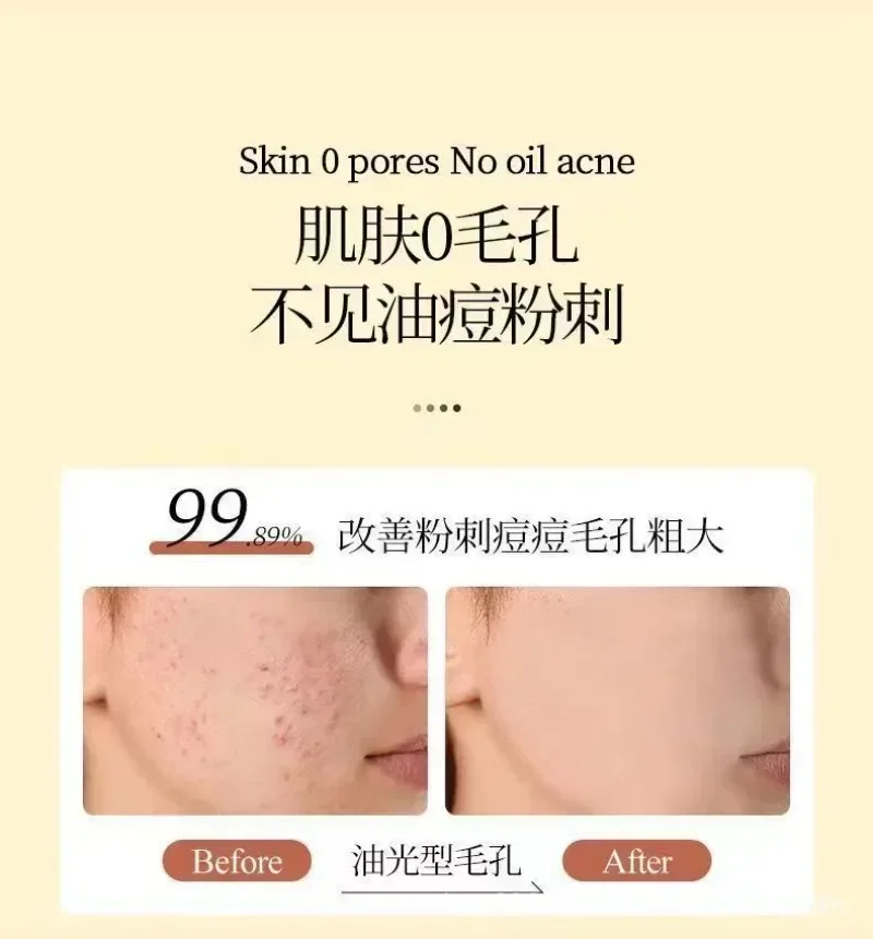 Japanese Lotton CC Essence Brightening Vitamin VC Beauty Essence Facial Acne Removal Upgraded Version 20ml Skin Care Products 6