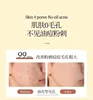Japanese Lotton CC Essence Brightening Vitamin VC Beauty Essence Facial Acne Removal Upgraded Version 20ml Skin Care Products 6