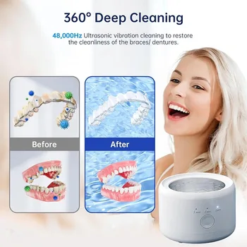 USB Powered Dental Appliance Cleaner Machine for Braces Dentures Jewelry - Oral Care Gift for Teeth Whitening Devices 1