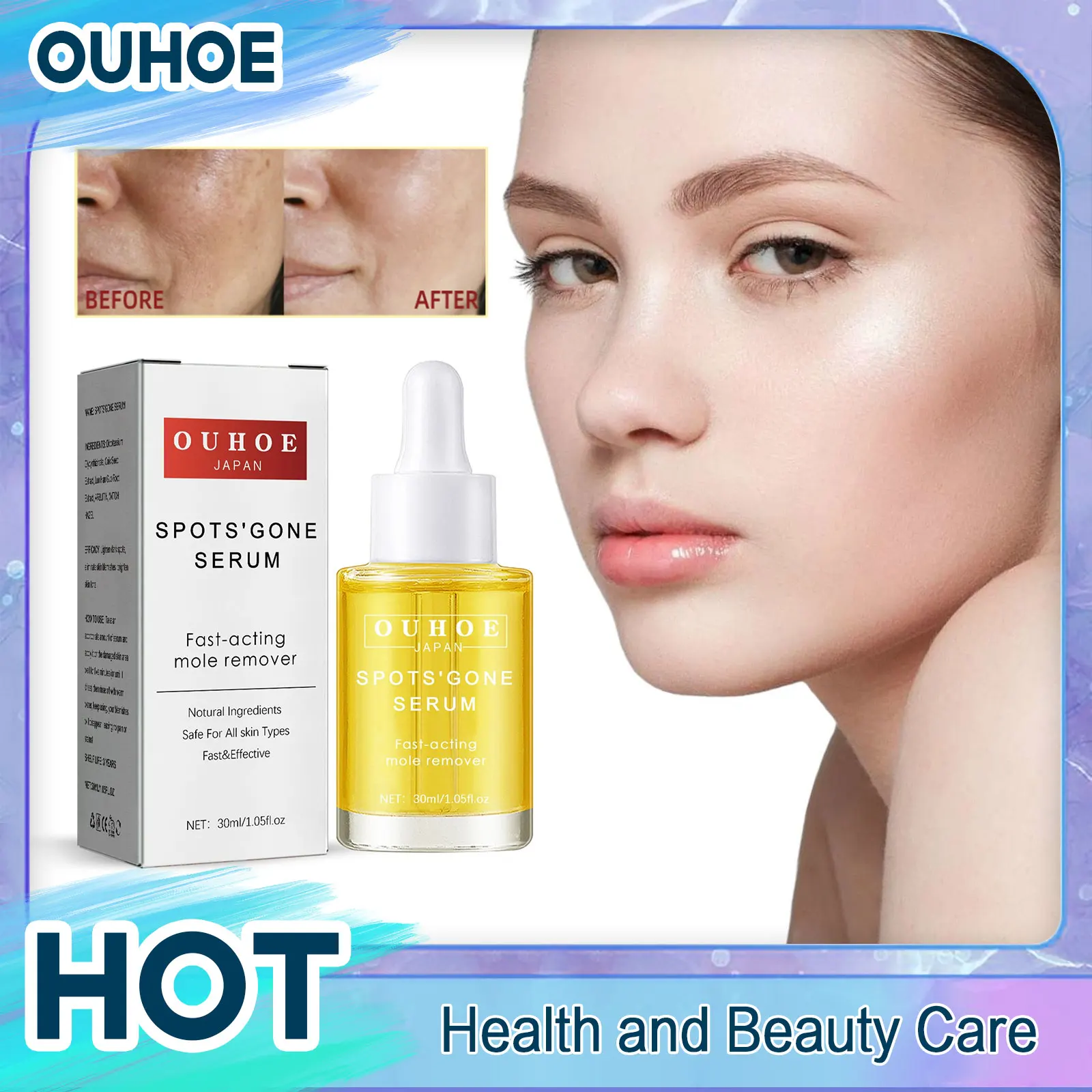 Freckle Removal Serum Skin Whitening Blemish Reduce Age Spots Brightening Fade Pigmentation Melasma Dark Spot Corrector Essence