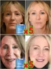 Restore your beautiful appearance 4