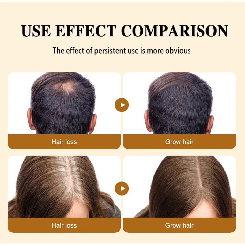 50ML African Hair Growth Oil Pure Batana Hair Growth Mask Butter