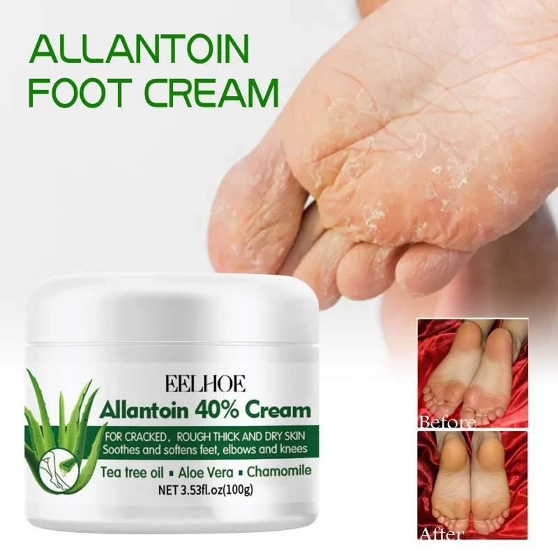 

Foot care cream heel Dead skin removal Callus anti dry Cracked peeling hydrating moisturize exfoliation chapped repair feet mask