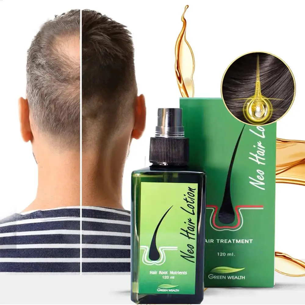 

120ml Thailand Original Neo Hair Lotion Anti Hair Loss 100% Hair Grow Treatment Spray Natural Hair Regrowth Care Essence for Men