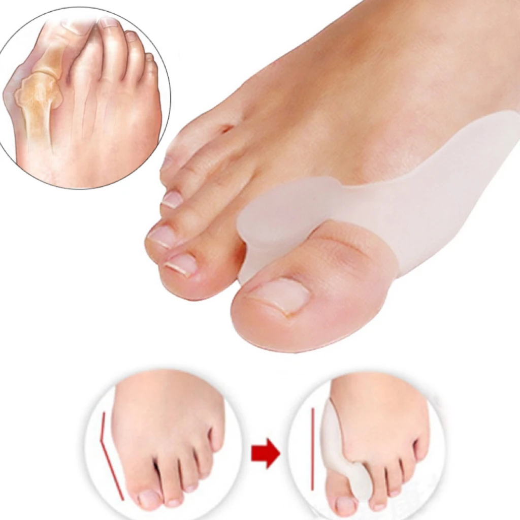 

2Pcs Silicone Gel Thumb Corrector Bunion Little Toe Protector Separator Hallux Valgus Finger Straightener Foot Care Relief Pads