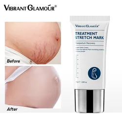 Crocodile Stretch Marks Remover Pregnancy Scars Ance Cream Maternity Repair Anti Aging Winkles Firming Body Care