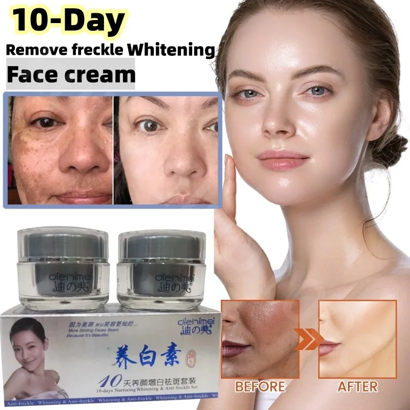 Anti-Pigment Face Whitening Cream Powerful Effects Whitening Anti Freckle Melasma Bleaching Remove Dark Spots Skin Care Products bleaching cream for dark skin intense top quality bleaching whitening cream for face neck hands and feet without side effects